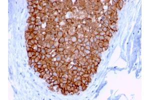 Immunohistochemistry (IHC) image for anti-Receptor tyrosine-protein kinase erbB-2 (ErbB2/Her2) (AA 311-462) antibody (ABIN6939319)