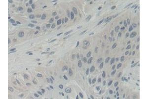 Immunohistochemistry (IHC) image for anti-ATP-Binding Cassette, Sub-Family B (MDR/TAP), Member 5 (ABCB5) (AA 570-808) antibody (ABIN7442258)