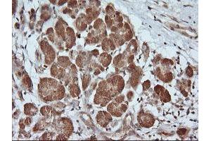 Image no. 2 for anti-Parvin, alpha (PARVA) antibody (ABIN1496444) (Parvin alpha 抗体)