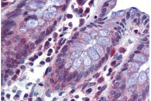 Human Colon: Formalin-Fixed, Paraffin-Embedded (FFPE) (SRSF4 抗体  (AA 395-444))