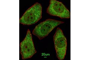 Immunofluorescent analysis of A549 cells, using MSRA Antibody (N-term) (ABIN391489 and ABIN2841456). (MSRA 抗体  (N-Term))