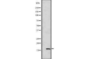 Western blot analysis of HSPB9 expression in A549 cell line lysates ,The lane on the left is treated with the antigen-specific peptide. (HSPB9 抗体  (C-Term))