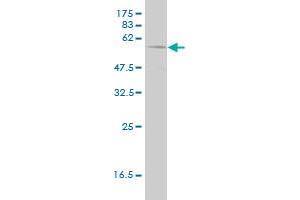 PHGDH monoclonal antibody (M01), clone 4A3-1D6.