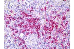 Anti-CD45RB antibody IHC of human spleen, lymphocytes. (CD45RB 抗体)