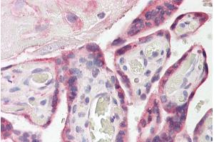 Immunohistochemistry (IHC) image for anti-Extended Synaptotagmin-Like Protein 1 (ESYT1) (Internal Region) antibody (ABIN334395)