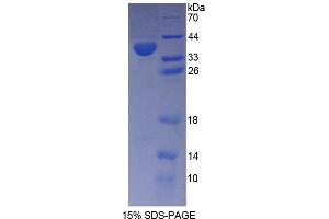 SDS-PAGE analysis of Human PMM1 Protein. (PMM1 蛋白)