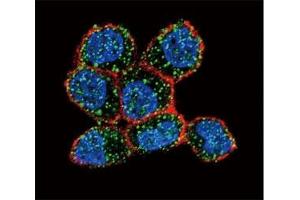 Confocal immunofluorescent analysis of Estrogen Receptor antibody with ZR-75-1 cells followed by Alexa Fluor 488-conjugated goat anti-rabbit lgG (green). (Estrogen Receptor alpha 抗体  (AA 246-273))