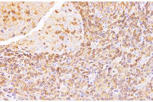 Immunohistochemistry of paraffin-embedded Human tonsil using Anxa6 Polyclonal Antibody at dilution of 1:100 (ANXA6 抗体)