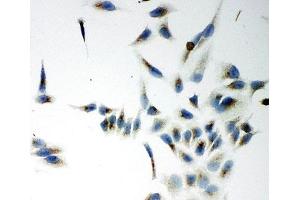 ICC testing of NOX5 antibody and HeLa cells (NOX5 抗体  (C-Term))