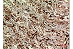 Immunohistochemistry (IHC) analysis of paraffin-embedded Human Kidney, antibody was diluted at 1:100. (IDH1 抗体  (N-Term))
