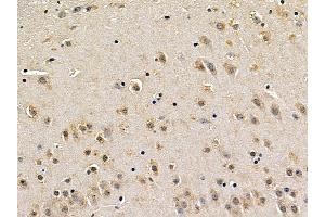 MEK1 Mouse Monoclonal Antibody at 1/100 staining mouse brain tissue by IHC-P. (MEK1 抗体  (Internal Region))