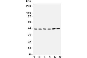 Western blot testing of TRAM antbody;  Lane 1: rat brain;  2: (r) kidney;  3: human 293T;  4: (h) Raji;  5: (h) Jurkat cell lysate. (TICAM2 抗体  (C-Term))