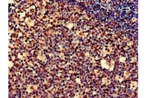 Immunohistochemistry of paraffin-embedded human tonsil tissue using ABIN7162722 at dilution of 1:100 (PDLIM2 抗体  (AA 161-284))