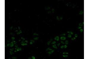 Detection of SMN in Human Hela Cells using Polyclonal Antibody to Survival Motor Neuron Protein (SMN) (SMN1 抗体  (AA 2-294))