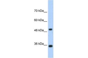 Western Blotting (WB) image for anti-Fructose-1,6-Bisphosphatase 1 (FBP1) antibody (ABIN2462400) (FBP1 抗体)