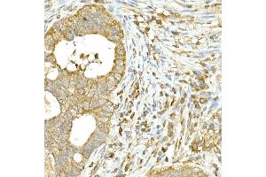Immunohistochemistry (IHC) image for anti-Keratin 14 (KRT14) (C-Term) antibody (ABIN7268092)