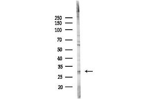 anti-Acyl-CoA Binding Domain Containing 6 (ACBD6) (Internal Region) antibody