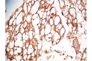 Mouse visceral fat tissue was stained by Rabbit Anti-Cathepsin S (298-331) (Human) Serum (Cathepsin S 抗体  (AA 298-331))