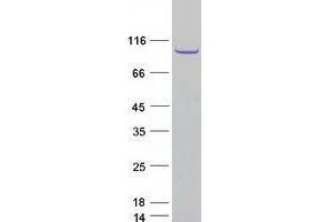 TPX2 Protein (Myc-DYKDDDDK Tag)