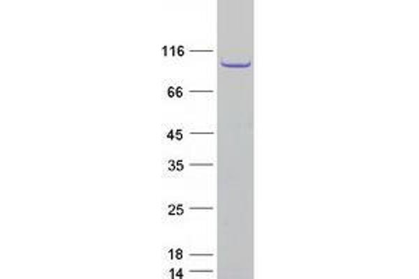 TPX2 Protein (Myc-DYKDDDDK Tag)