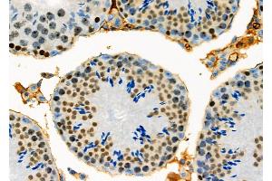 ABIN6261387 and ABIN6278336 at 1/100 staining Mouse testis tissue by IHC-P. (DUX4 抗体)