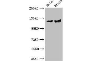 Western Blot Positive WB detected in: Hela whole cell lysate, Mouse brain tissue All lanes: RASA1 antibody at 3.