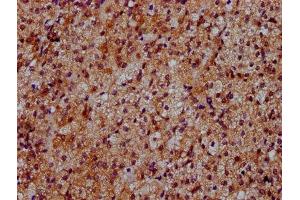 IHC image of ABIN7150800 diluted at 1:500 and staining in paraffin-embedded human adrenal gland tissue performed on a Leica BondTM system. (Dymeclin 抗体  (AA 224-348))