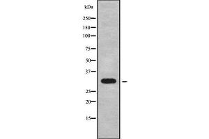 Western blot analysis of CYB5R2 using 293 whole cell lysates (CYB5R2 抗体  (Internal Region))