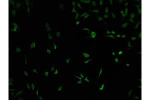 Immunofluorescence staining of SH-SY5Y cells with ABIN7152090 at 1:100, counter-stained with DAPI. (ELF2 抗体  (AA 1-353))