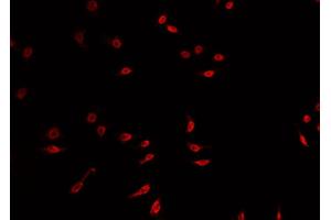 ABIN6269136 staining A549 cells by IF/ICC. (FGFR1 抗体  (C-Term))