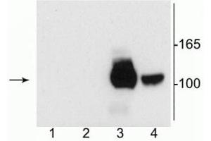 Western Blotting (WB) image for anti-Glutamate Receptor, Ionotropic, N-Methyl D-Aspartate 1 (GRIN1) (Splice Variant C2') antibody (ABIN361404)