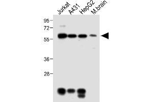 All lanes : Anti-MeCP2 Antibody at 1:2000 dilution Lane 1: Jurkat whole cell lysate Lane 2: A431 whole cell lysate Lane 3: HepG2 whole cell lysate Lane 4: Mouse brain lysate Lysates/proteins at 20 μg per lane. (MECP2 抗体  (AA 400-428))