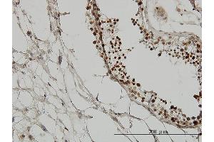 Immunoperoxidase of monoclonal antibody to TRIM33 on formalin-fixed paraffin-embedded human testis. (TRIM33 抗体  (AA 1006-1105))
