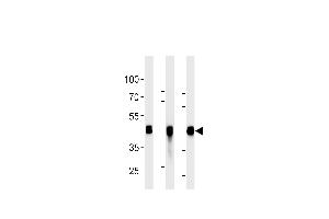 All lanes : Anti-CYK18 Antibody (C-term) at 1:2000 dilution Lane 1: HepG2 whole cell lysates Lane 2: K562 whole cell lysates Lane 3: NCI- whole cell lysates Lysates/proteins at 20 μg per lane. (Cytokeratin 18 抗体)