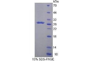 SDS-PAGE (SDS) image for Acyl-CoA Dehydrogenase, Long Chain (ACADL) (AA 214-430) protein (His tag) (ABIN4989943) (ACADL Protein (AA 214-430) (His tag))