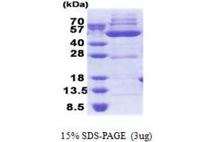 SDS-PAGE (SDS) image for 3-Oxoacyl-ACP Synthase, Mitochondrial (OXSM) (AA 28-459) protein (His tag) (ABIN5853265) (OXSM Protein (AA 28-459) (His tag))