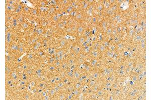 ABIN6258263 and ABIN6273482 at 1/100 staining Rat brain tissue by IHC-P.