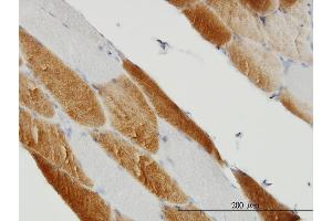 Immunoperoxidase of monoclonal antibody to SDHC on formalin-fixed paraffin-embedded human skeletal muscle. (SDHC 抗体  (AA 1-169))