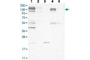 Western blot analysis of Lane 1: RT-4, Lane 2: U-251 MG, Lane 3: Human Plasma, Lane 4: Liver, Lane 5: Tonsil with CGN polyclonal antibody  at 1:250-1:500 dilution. (Cingulin 抗体)