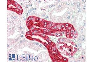 ABIN5539884 (5µg/ml) staining of paraffin embedded Human Kidney. (MEX3C 抗体  (AA 541-554))