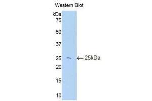 Western Blotting (WB) image for anti-TIMP Metallopeptidase Inhibitor 3 (TIMP3) (AA 27-209) antibody (ABIN1860762) (TIMP3 抗体  (AA 27-209))