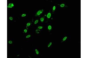 Immunofluorescence staining of Hela cells with ABIN7155093 at 1:166, counter-stained with DAPI. (HNRNPAB 抗体  (AA 1-68))