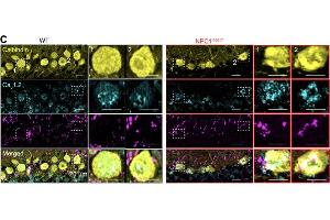 Representative maximum intensity projections from WT (black) and NPC1I1061T (red) mouse cerebellar sagittal sections co-immunolabeled for Calbindin(cat.