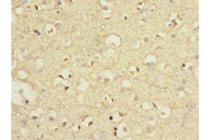 Immunohistochemistry of paraffin-embedded human brain tissue using ABIN7159448 at dilution of 1:100 (GRM7 抗体  (AA 220-410))