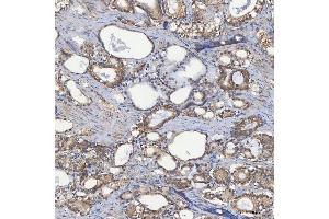 IHC analysis of SEC23IP using anti-SEC23IP antibody (ABIN7601222).