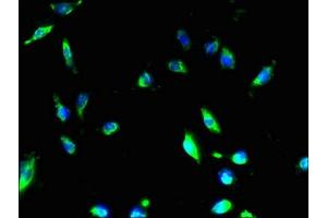 Immunofluorescent analysis of U251 cells using ABIN7160187 at dilution of 1:100 and Alexa Fluor 488-congugated AffiniPure Goat Anti-Rabbit IgG(H+L) (MMD2 抗体  (AA 1-38))