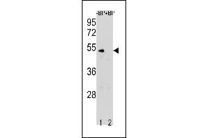 Western blot analysis of CCNB1 Antibody (N-term S9) Pab (ABIN1881151 and ABIN2843318) pre-incubated without(lane 1) and with(lane 2) blocking peptide in K562 cell line lysate. (Cyclin B1 抗体  (N-Term))