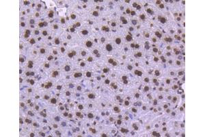 Paraformaldehyde-fixed, paraffin embedded human pancreas tissue, Antigen retrieval by boiling in sodium citrate buffer (pH6) for 15min, Block endogenous peroxidase by 3% hydrogen peroxide for 30 minutes, Blocking buffer (normal serum) at 37°C for 20min, Antibody incubation with Histone H1. (Histone H1 抗体)