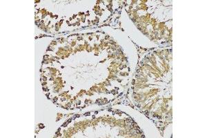Immunohistochemistry of paraffin-embedded mouse testis using HSPA9 antibody. (HSPA9 抗体  (AA 380-679))