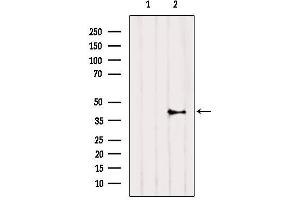Western blot analysis of extracts from HepG2, using CNR2 Antibody. (CNR2 抗体  (C-Term))